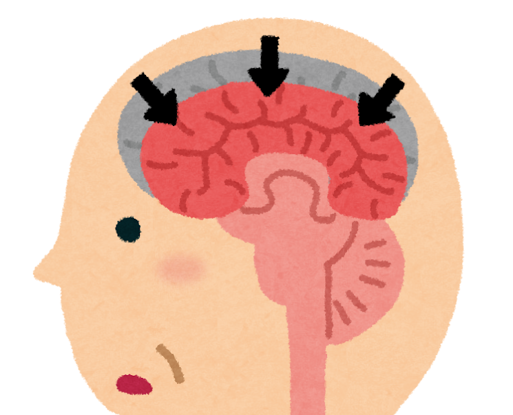 認知症は早期診断が大切